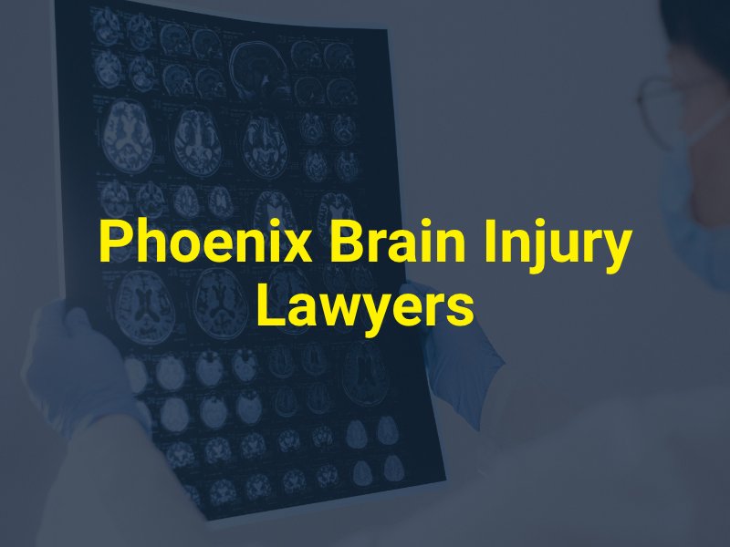 Phoenix Brain Injury Lawyers